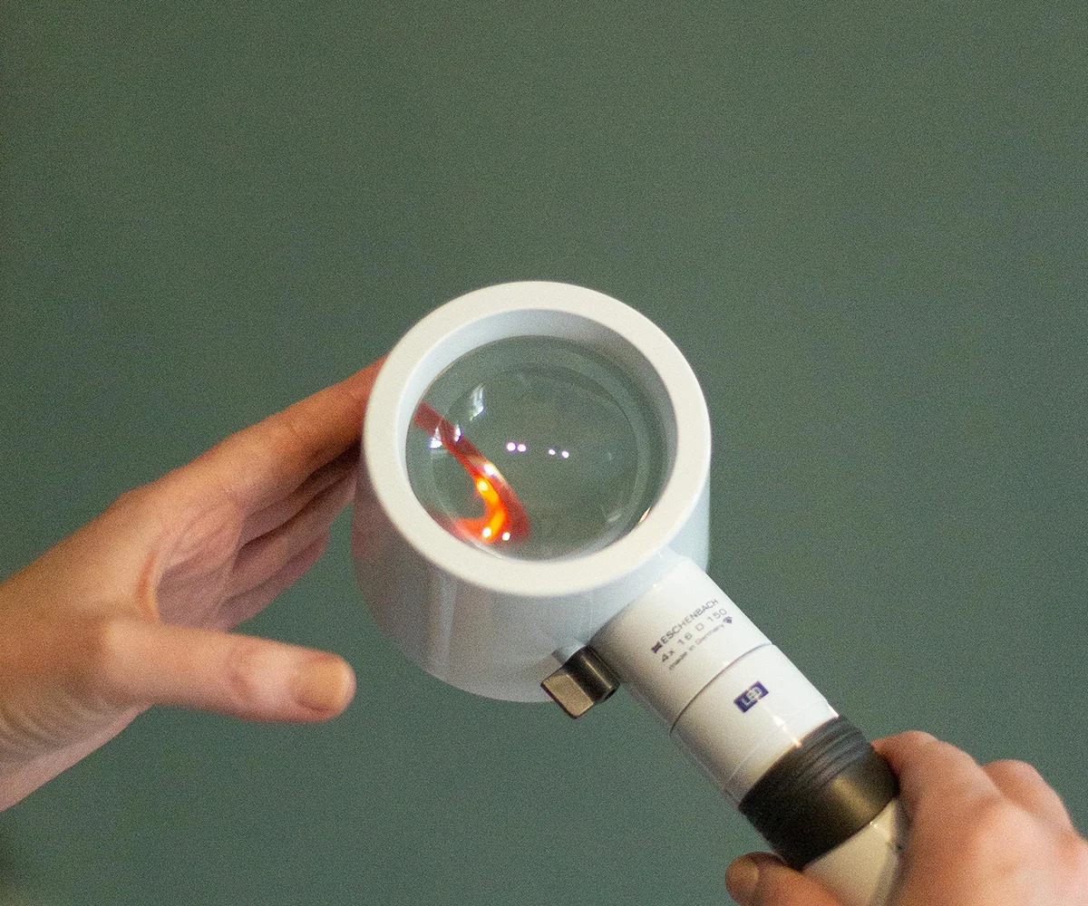 Dry eye treatment